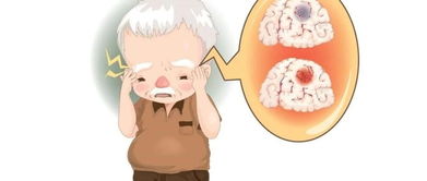 中風之中臟腑者若屬痰火,中風辨證要點有哪些?