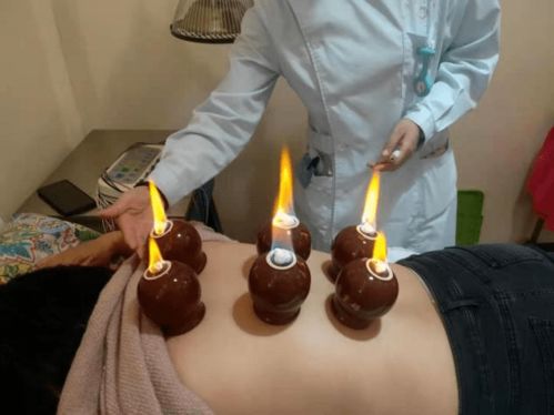 五行能量罐的好處,五行能量罐拔罐減肥管用嗎